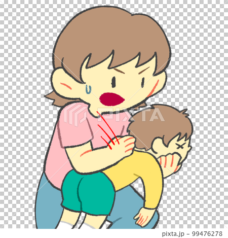 Back blow method infant child 99476278