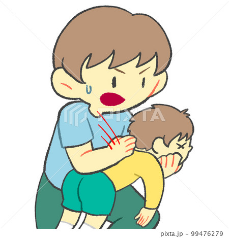 背部叩打法　幼児　子ども 99476279