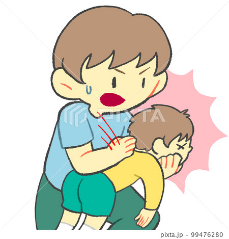 背部叩打法 幼児 子ども 背部叩打法 幼児 子ども 99476280