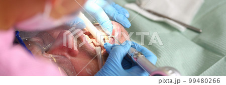 Patient with dentist checks teeth and drills tooth with caries 99480266