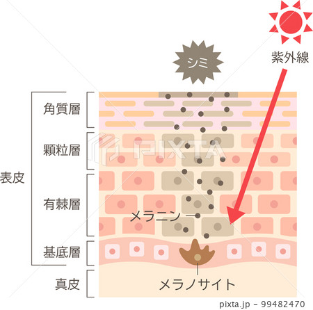 シミのしくみ　肌細胞と断面図 99482470