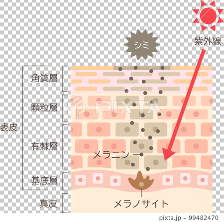 シミのしくみ　肌細胞と断面図 99482470