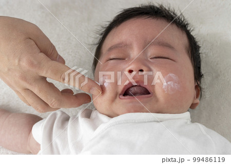 泣く赤ちゃんの顔にクリームを塗るイメージ(0歳2か月、日本人、男の子) 泣く赤ちゃんの顔にクリームを塗るイメージ(0歳2か月、日本人、男の子) 99486119