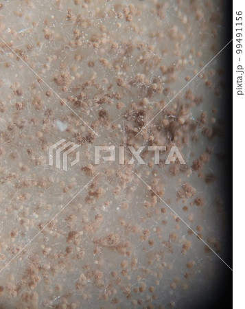 黒コウジカビの胞子に色がついていく様子 99491156