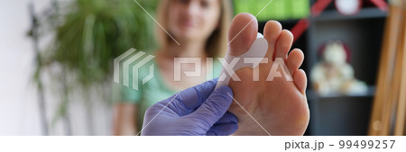 Doctor holds brace for hallux valgus closeup Doctor holds brace for hallux valgus closeup 99499257