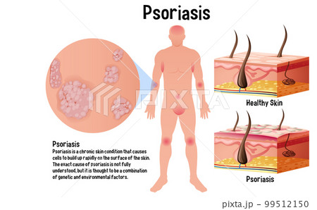 Human skin conditions infographic with explanation 99512150