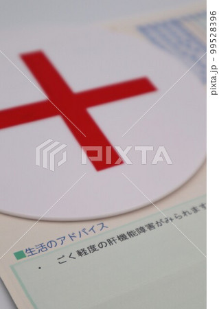 健康診断で軽度の肝機能障害 99528396