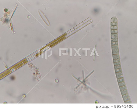 ユレモの仲間の顕微鏡写真 99541400
