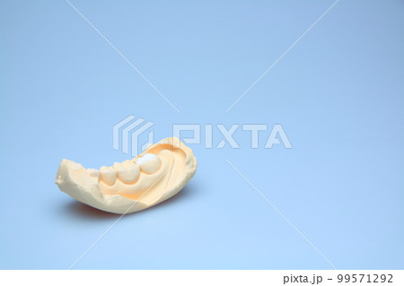 歯科石膏 歯科石膏 99571292