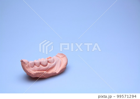 歯科石膏 99571294