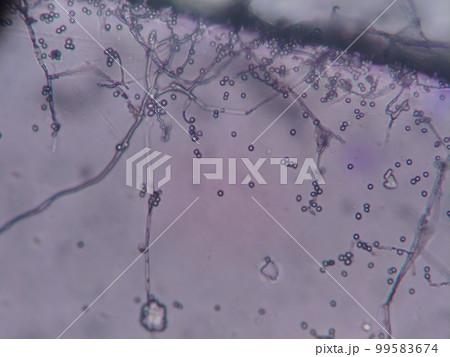 放線菌と思われる自然界採取の菌 99583674