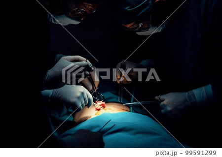 Surgical team performing surgery to patient in sterile operating room. Surgical team performing surgery to patient in sterile operating room. 99591299