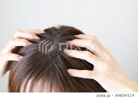 頭を触る女性　頭皮ケア 99604524