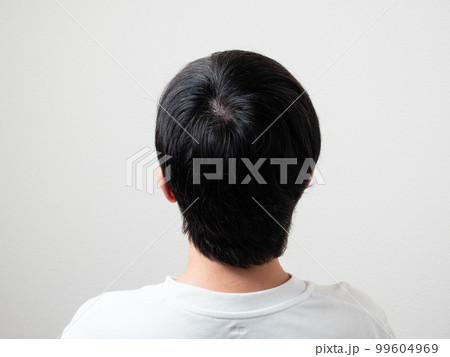 男性の後頭部　髪の毛　つむじ 99604969