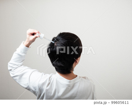 育毛剤を塗る男性　後頭部　髪の毛 99605611