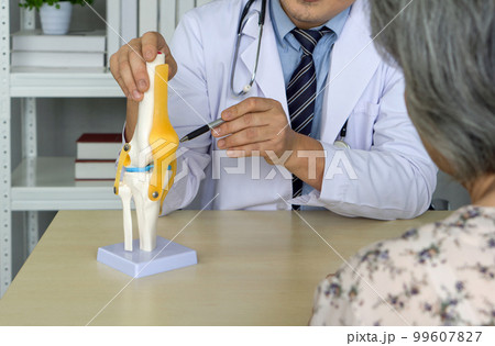 Orthopedic Surgeon in white gown and stethoscope pointing at anterior cruciate ligament on deluxe functional knee joint model, present to the elderly patient about treatment of the knee with surgery. 99607827