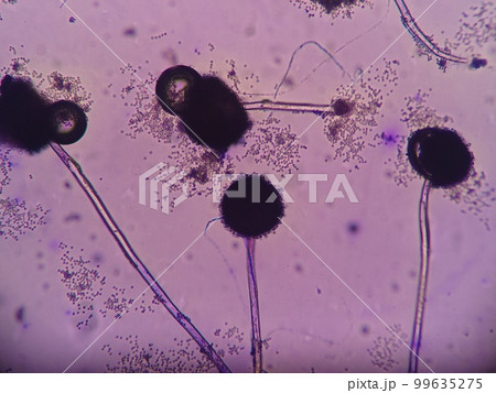 長い菌糸を伸ばした黒コウジカビ 99635275