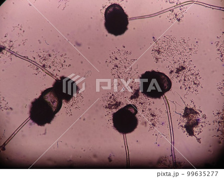 長い菌糸を伸ばした黒コウジカビ 99635277