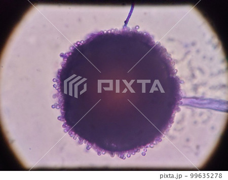 大きな黒コウジカビの胞子 99635278