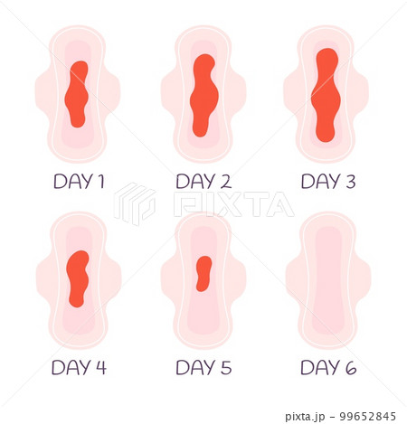Menstrual bleeding on pads. Period discharges, blood drops on sanitary pad. Female health, menstruation cycle and hygiene, racy vector set 99652845