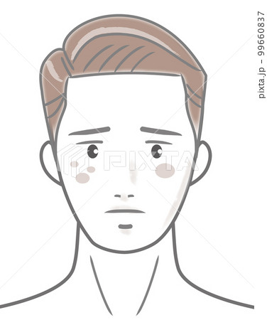 男性_タイプB_肌トラブル_シミ 99660837