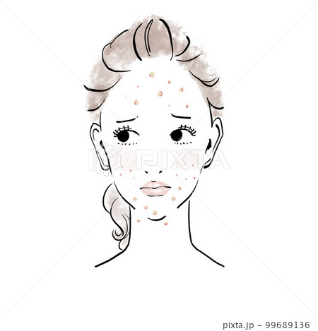 スキンケアイメージ　ニキビを気にする女性 99689136