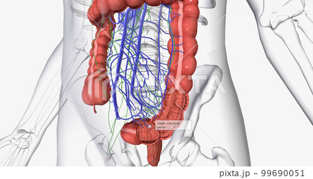Colorectal cancer (CRC) is a common colon or rectal cancer that affects many patients over middle age. Colorectal cancer (CRC) is a common colon or rectal cancer that affects many patients over middle age. 99690051
