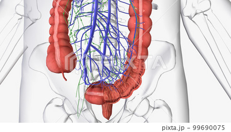 Colorectal cancer (CRC) is a common colon or rectal cancer that affects many patients over middle age. Colorectal cancer (CRC) is a common colon or rectal cancer that affects many patients over middle age. 99690075