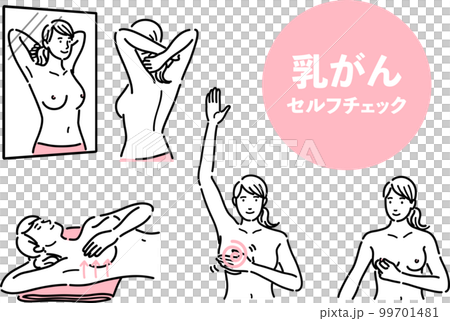 乳がんのセルフチェックをしている女性のセット 99701481