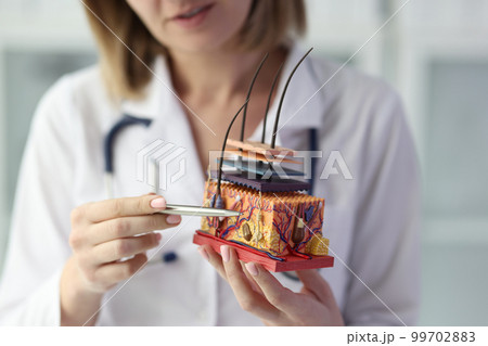 Female dermatologist holding artificial model of human skin with hair 99702883