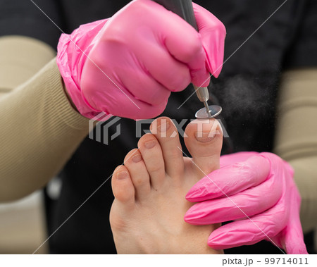 A pedicurist treats the toes of a client using a machine with an abrasive disc in a beauty salon. A pedicurist treats the toes of a client using a machine with an abrasive disc in a beauty salon. 99714011