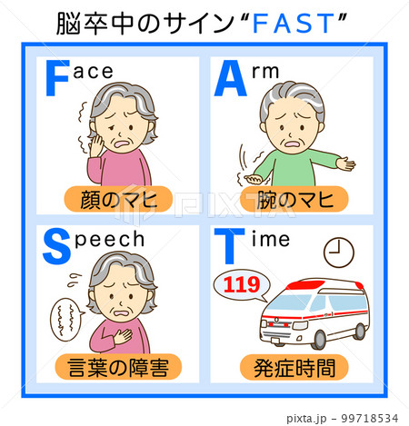 脳卒中チェックFASTの説明イラスト2 99718534