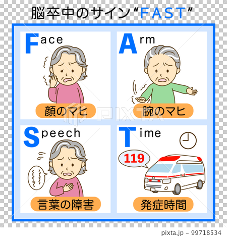 脳卒中チェックFASTの説明イラスト2 99718534
