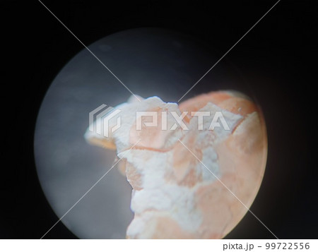 米の塊に生えたカビ 99722556