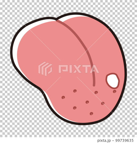 口内炎ができた舌のイラスト 99739635
