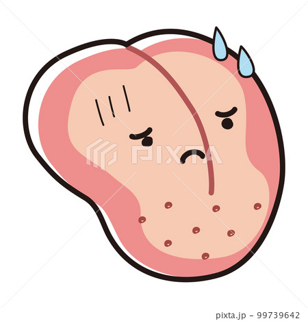 舌に汚れが付いた（舌苔）キャラクター 99739642