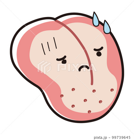 白くなった舌（舌苔、舌癌）のキャラクター 99739645