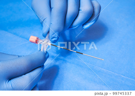 Epidural Anesthesia. Needle for anesthesia in the hands of a medic in protective gloves Epidural Anesthesia. Needle for anesthesia in the hands of a medic in protective gloves 99745337