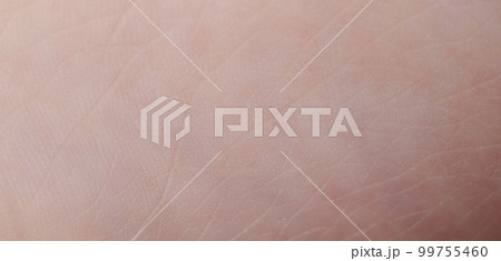 Lines on human skin background Lines on human skin background 99755460