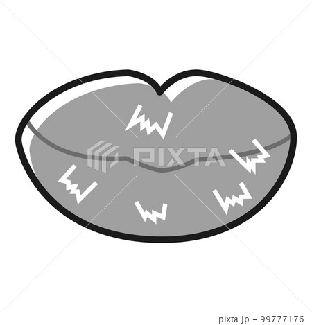 ガサガサに荒れて皮がむけたくちびる(白黒) 99777176