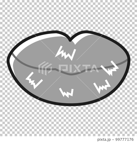 ガサガサに荒れて皮がむけたくちびる(白黒) 99777176