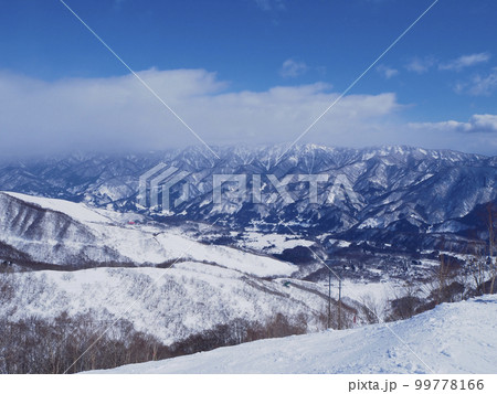 栂池高原スキー場 馬の背コース 栂池高原スキー場 馬の背コース 99778166