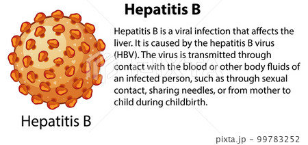 Hepatitis B with explanation Hepatitis B with explanation 99783252