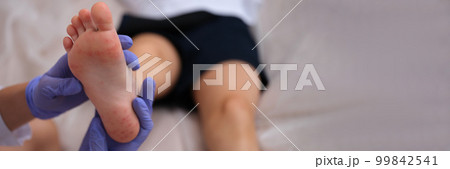 Infectious disease doctor examining rash on skin of child feet closeup 99842541