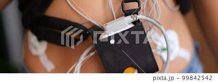 Ecg holter monitor hanging on patient body closeup 99842542