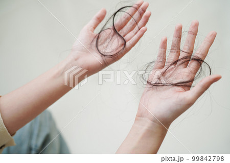 Asian woman have problem with long hair loss attach in her hand. 99842798