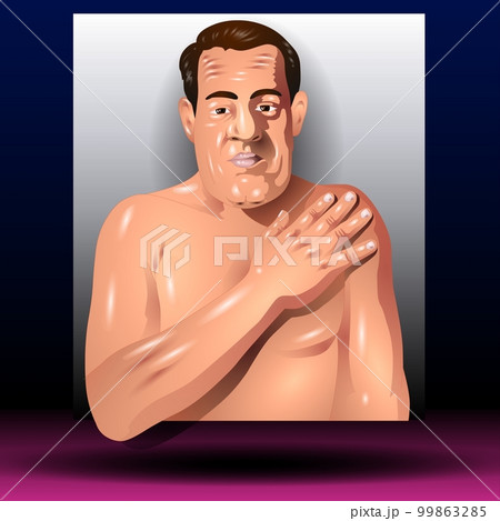 Abnormal Hand Growth - Medical - Human Body - Health - Graphic 99863285