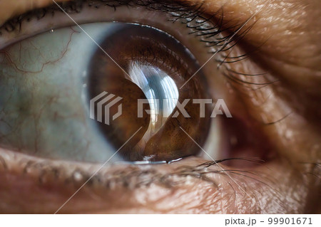 Extreme macro closeup of a human eye with a light brown shiny iris surrounding the pupil and light reflected from a window 99901671