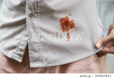 Hand showing dirty sauce stain on shirt from accident in eating in daily life. selective focus. stain for cleaning Hand showing dirty sauce stain on shirt from accident in eating in daily life. selective focus. stain for cleaning 99962841