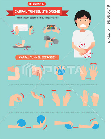 Carpal tunnel syndrome infographic vector illustration. 99990149